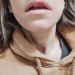 Dana Rogoz Instagram - 134/366 Un alt fel de INAINTE/DUPA. Cea de a doua imagine este de acum, dupa ce în aceasta dimineata am fost cusuta la spital, în zona buzei. Un incident stupid.. am dat practic "buza in cap" cu Lia. Iar capul Liei e foarte rezistent, ea nu a avut nimic. Eu în schimb am avut nevoie de 4 ate care sa imi stranga buza la loc. Problema mea cea mai mare ca e în seara aceasta plec la Baia Mare, pentru ca mâine e programat spectacolul "Domnisoara Iulia". Asadar, tineti-mi pumnii ca sa pot juca! 🙏