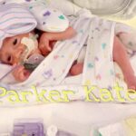 Danielle Busby Instagram – My baby E – Quintuplet, Parker Kate💛
I call you my “baby baby” because you are my official baby of all my babies ☺️ There are so many great strong qualities about you, it’s hard to sum it all up. You are such a  perfectionist, a good leader, and so talented at all the things you do! You have come so far with the struggles of anxiousness and we have seen you grow so much confidence ! You are a true beauty and my little fashionista. I love that you love to cuddle and one of your fav things is to be cozy in pjs & blankets. You have become so bold and strong…and a bunch of bossy 🤣 You accomplish anything you put your mind too and I love that you push yourself to overcome fears with wanting to try new things! You have ALWAYS been a Daddy’s girl but this most recent year, I do believe.. my baby baby 🥰… that you are a total MAMA’s GIRL NOW! 
You amaze me every day and I’m so thankful that God gave me you.  Celebrating you as a #nicugraduate 8 years ago 💚 Thank you Lord for this precious child 💚 #nicuawarenessmonth💚 #nicubaby #itsabuzzworld #outdaughtered #quintuplets