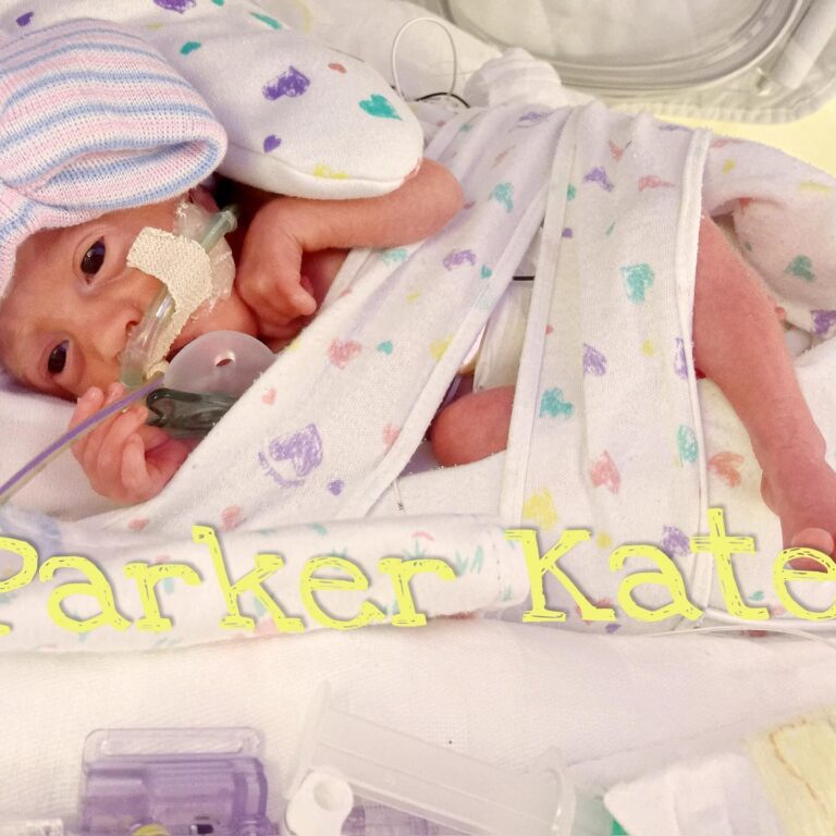 Danielle Busby Instagram - My baby E - Quintuplet, Parker Kate💛 I call you my “baby baby” because you are my official baby of all my babies ☺️ There are so many great strong qualities about you, it’s hard to sum it all up. You are such a perfectionist, a good leader, and so talented at all the things you do! You have come so far with the struggles of anxiousness and we have seen you grow so much confidence ! You are a true beauty and my little fashionista. I love that you love to cuddle and one of your fav things is to be cozy in pjs & blankets. You have become so bold and strong…and a bunch of bossy 🤣 You accomplish anything you put your mind too and I love that you push yourself to overcome fears with wanting to try new things! You have ALWAYS been a Daddy’s girl but this most recent year, I do believe.. my baby baby 🥰… that you are a total MAMA’s GIRL NOW! You amaze me every day and I’m so thankful that God gave me you. Celebrating you as a #nicugraduate 8 years ago 💚 Thank you Lord for this precious child 💚 #nicuawarenessmonth💚 #nicubaby #itsabuzzworld #outdaughtered #quintuplets