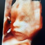 Diane Medina Instagram - 3D/4D of our Baby Girl at @babybondultrasound.ph 💖 Thank you so much @babybondultrasound.ph for accommodating us! Super happy nagpakita agad si Baby! Heheh Love you anak 🌸 To all the Preggy Mommas, you can have your Ultrasound Check up, Congenital Anomaly Scan, 3D/4D Live Ultrasound with Printed Scans and Frame just message @babybondultrasound.ph located at 3rd level of SM The Block 🌸