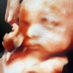 Diane Medina Instagram - 3D/4D of our Baby Girl at @babybondultrasound.ph 💖 Thank you so much @babybondultrasound.ph for accommodating us! Super happy nagpakita agad si Baby! Heheh Love you anak 🌸 To all the Preggy Mommas, you can have your Ultrasound Check up, Congenital Anomaly Scan, 3D/4D Live Ultrasound with Printed Scans and Frame just message @babybondultrasound.ph located at 3rd level of SM The Block 🌸