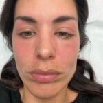 Dulceida Instagram - vale, mi carrete está lleno de este tipo de fotos… y me hace gracia (y un poco de vergüenza que no tengo 🙄) dejarlas por aquí 🫠 la tercera es de cuando estuve ingresada con una alergia brutal y todo lo demás de momentos maravilla ✨🫰🏻