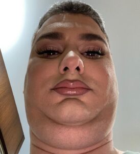 Ethan Klein Instagram - One more for my brothers