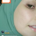 Faezah Elai Instagram - Ni masa live kt tiktok last week.. without any filter..mcm ni lah rupa kulit cheq lani.. klu ushar betoi2 mmg scars still ada Tp sgt pudar.. Been using dermaroller 9 tahun di rumah so ni lah hasil nya.. Klu ampa dh try mcm2 skincare Tp tk menjadi it’s time for treatment.. tk payah stop skincare ampa.. just add on @officialpurestbyfaezahelai on ur daily skincare routine.. . Skrg tgh 50% off all item..half price ja ampa.. lekaih pi beli kt @shopee_my @lazada_my Tiktok Atau whatsapp 0123095202 our skin consultant.. For more info or testimonials boleh visit our IG @officialpurestbyfaezahelai @officialpurestbyfaezahelai @officialpurestbyfaezahelai . #purestbyfe #skincare #skincarejunkie #homemicroneedling #dermaroller #faezahelai