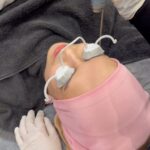Faezah Elai Instagram – Salam ampa maini nk share ngan ampa.. maini try buat treatment muka  kt @clinicrxmy bangi
Q-Switched Laser as it is one of the most effective laser treatments currently available, and provides different wavelength, suited to different skin conditions.

Q-Switched can be treated for:

-Melasma
-Skin rejuvenation
-Skin Whitening/ Brightening
-Post-Inflammatory Hyperpigmentation
.
First ampa buat treatment ni.. kulit maini lembut elok ampa.. mcm budak lepaih spm.. 🫣
Ampa Klu ada duit lebih pi try lekaih treatment.. sebut nama maini insyallah dpt discount!! 😆
.
#rxclinic #treatment #facetreatment #faezahelai