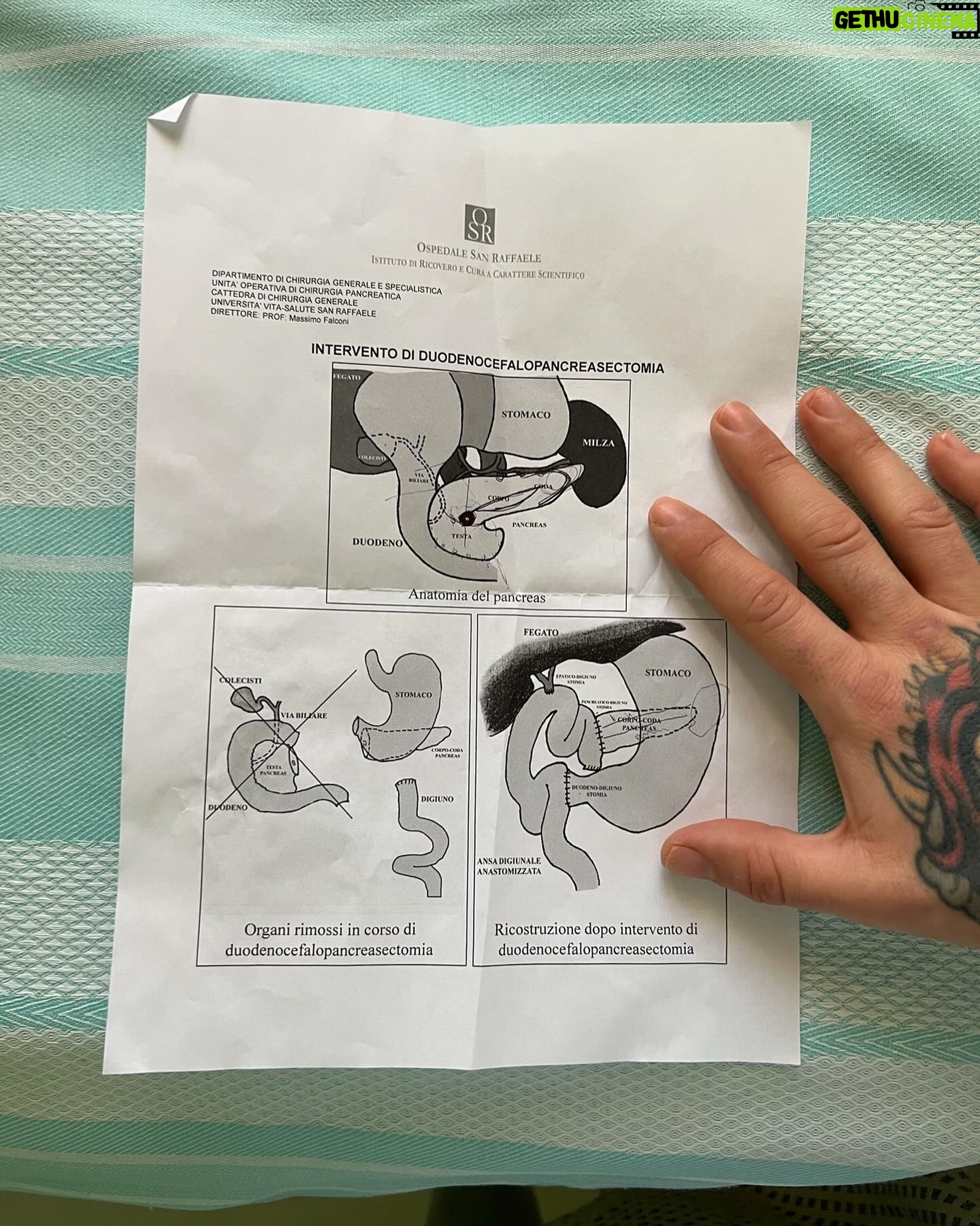 Fedez Instagram - Esattamente 2 anni fa mi operavo di tumore al pancreas. 2 fottuti anni! La vita è bella ❤️💪🏻