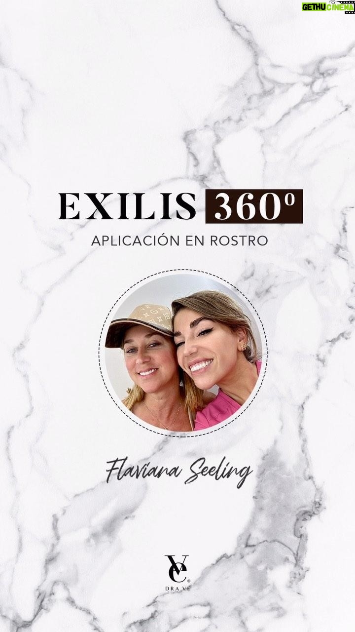 Flaviana Seeling - 205 Likes - Exilis Ultra 360º resulta ser una opción maravillosa para tensar y lograr un efecto lifting en la piel de forma inmediata de forma no invasiva.
Reduce los depósitos de grasa localizada. Estimula la producción de colágeno en la piel provocando la formación de colágeno nuevo, tanto en la piel como en el tejido subcutáneo, y produce una reestructuración del colágeno profundo.
Nuestra queridísima @flavianaseeling vino a mi clínica para mejorar la calidad de su piel para verse fantástica en su próximo Tour con Axe Bahía ✨🌸 aún nos quedan por realizar 6 sesiones, el resultado que hemos obtenido hasta el momento es simplemente maravilloso 🙌🏽
Cuéntanos ¿Qué te parece cómo vamos?
__
#DraVe #PerfectBody #ExilisUltra360 #MedicinaEstetica #ArmonizacionFacial #FullFace #AcidoHialuronico #Botox #Fillers #Colageno #bioestimuladores #chile #Lifting
