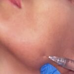Gala Caldirola Instagram - Siento que rejuvenecí 5 años después de esta visita a @clinicarossilemarie 😍 Este tratamiento es increíble🤍 La REDENSIFICACIÓN, nuevo tratamiento de rejuvenecimiento facial sin cirugía enfocado en corrección y prevención del envejecimiento cutáneo 💎