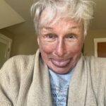 Glenn Close Instagram - I think this is going to be a particularly GOOD day. (Ignore the bruises. I had a tiny break in my nose fixed) Feeling as beautiful as ever.