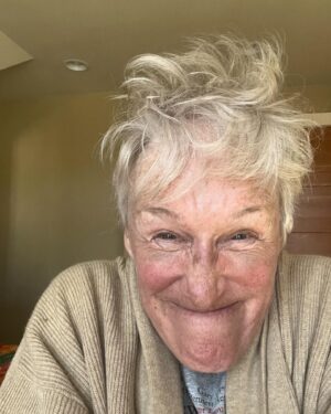 Glenn Close Instagram - I think this is going to be a particularly GOOD day. 
(Ignore the bruises. I had a tiny break in my nose fixed) Feeling as beautiful as ever.