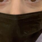 Grace Helbig Instagram - Just posted a little surgery vlog! It was wild and whacky but we’re healing up well. There’s a part 2 of the Q&A at the end too. Lots of rambles about telling people about my diagnosis, thoughts on 2024, and some tips on talking to doctors. Link in the bio if you wanna watch! 💪🏻💫