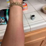 Hayley Kiyoko Instagram - I’ve had a migraine for a week and I’m allergic to everything.