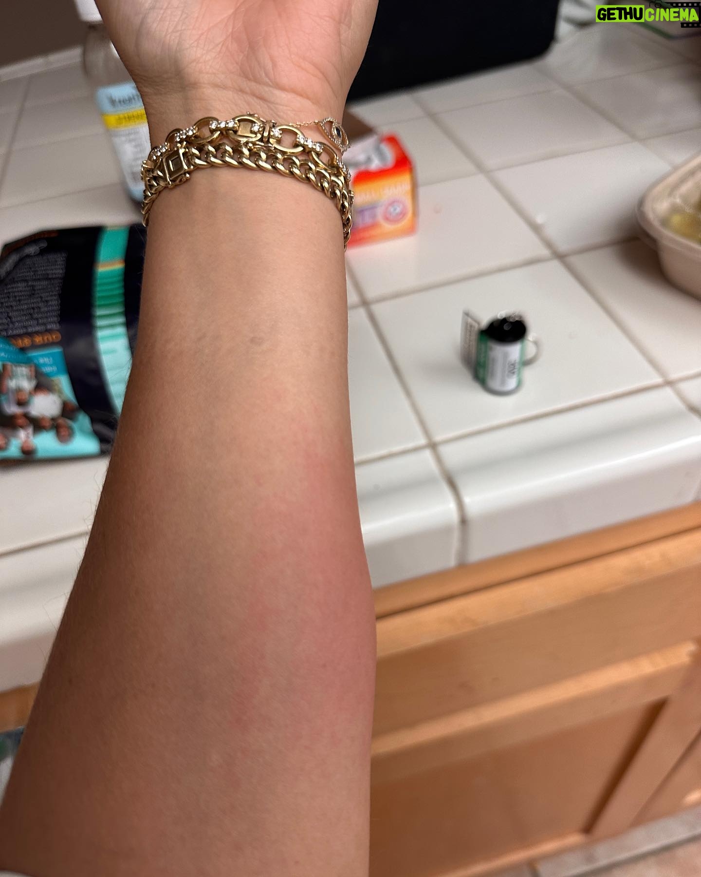 Hayley Kiyoko Instagram - I’ve had a migraine for a week and I’m allergic to everything.