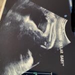 Hilary Swank Instagram – Baby A flexing for the camera at their ultrasound. 💪🏽🤣
#TheRealMillionDollarBaby #Prizefighter