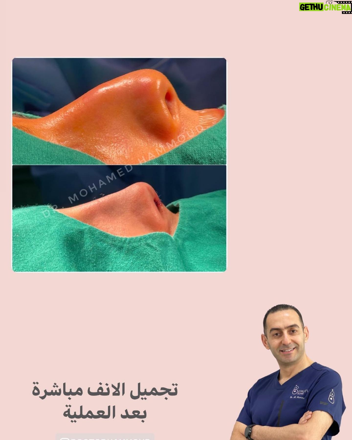Huda Husain Instagram - دكتور محمد حمود وعملية جفوني القادمه بتكون معاه في عيادة بيوتي كلينك @beautyclinick