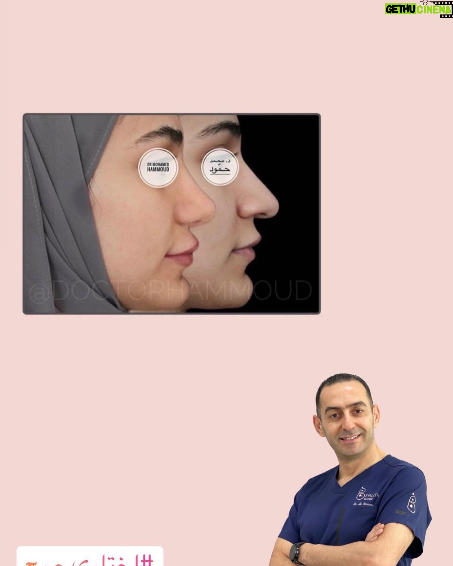 Huda Husain Instagram - دكتور محمد حمود وعملية جفوني القادمه بتكون معاه في عيادة بيوتي كلينك @beautyclinick