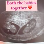 Jamie Otis Instagram - I can’t thank you enough for all the love, encouragement, and prayers over the last week. Whew, I’ve been on an emotional roller coaster with these babies. So happy to hear and be able to share ALL IS WELL WITH BOTH OF THEM!🙏❤️ PS these are Live Photos and it wouldn’t let me keep the audio so nvm the random Gracie chatter and doc chatter!😅 #bestfrans
