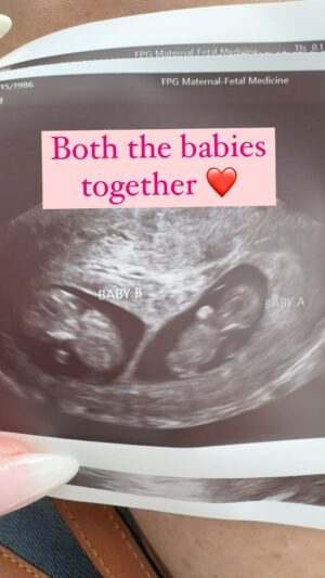 Jamie Otis Instagram - I can’t thank you enough for all the love, encouragement, and prayers over the last week. 

Whew, I’ve been on an emotional roller coaster with these babies. So happy to hear and be able to share ALL IS WELL WITH BOTH OF THEM!🙏❤️

PS these are Live Photos and it wouldn’t let me keep the audio so nvm the random Gracie chatter and doc chatter!😅

 #bestfrans