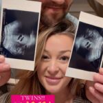 Jamie Otis Instagram - I was diagnosed with infertility after my second baby - it didn’t make sense since I’ve already had children. I decided to do everything I could to try to help myself.💪🤰❤️ I quit drinking alcohol & my daily pot of coffee. I switched to green tea and began incorporating more fruits and veggies in my diet. I cut waaaay back on the processed junk I was eating and I tried to avoid too much dairy and too much gluten (never successfully gave up either 100% bc TBH, I still “cheat” all the time)🤪😝 I got a gym membership and began going as much as I could. At first I could barely do the jump rope bc I was so out of shape, but slowly I began doing 1 then 2 then a dozen pushups *on my toes* — so proud of that 😜💪 We would go to church and pray for God’s will to be done with our family …& then tried our best to truly BELIEVE it would be.🙏 I began meditating every👏single👏night👏 ….I know this isn’t always the answer for those who struggle with fertility (and it still took us a loooong time to get that positive test) but I figured I’d share what I did that I think was somewhat helpful bc I know the fertility journey is so isolating and lonely — especially when it’s secondary infertility and if you even mention wanting more kids it’s assumed you don’t appreciate the ones you already have.🤦🏼‍♀️ If your heart is aching for a child and you’ve been told you can’t have one, I’m so sorry. It’s a pain that pierces your soul and not a lot of people understand.😔 I found going to the fertility doctor was so helpful to find out what I could about what was “wrong” w me and then I found it so helpful to try to change my lifestyle to see if it’d help.🤷🏼‍♀️ We are now pregnant WITH TWINS. I didn’t have any fertility meds or treatment … these babies came to us spontaneously!🙏🙏🙏 I wanted to share this in hopes it can give someone who’s been on the same trying to conceive struggle bus some HOPE.🙏 My heart goes out to those of you struggling with growing your family…I’m sending you so so so much love & lots of sticky baby dust.❤️