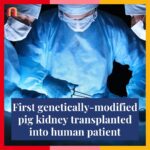 Jessica Yellin Instagram - MEDICAL BREAKTHROUGH: HUMAN PATIENT GETS PIG KIDNEY Surgeons at Massachusetts General Hospital transplanted a genetically-modified pig kidney into a patient with end-stage kidney disease. This is the first time such a procedure has been performed, and it could revolutionize treatment for kidney disease. The patient, a 62-year-old Black man named Rick Slayman, is doing well. His new kidney is functional, and he is reportedly well enough to walk around the hospital. There is currently a shortage of human kidneys available for transplant, while tens of millions of Americans have kidney disease. Over 100,000 Americans are in the kidney transplant waitlist. Black patients suffer disproportionately from end-stage kidney disease. With genetically modified pig kidneys, more of those in dire need of a kidney may have access to a life-saving transplant. Doctors are still monitoring Slayman closely for any sign of organ rejection, but one doctor on his team said he’s recovering very well: “He looks like his own self. It’s remarkable.”
