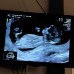 Jesta Hillmann Instagram – J’étais tellement pressé de savoir si j’étais enceinte que j’avais fais des tests bien trop tôt qui m’indiquaient tous négatif. J’avais dis à Benoît que ça n’avait pas marché cette fois ci dès le premier essai.. 2 jours plus tard, un soir je décide de faire un dernier test car mon corps me disait le contraire.. et paf ! Même si je suis tombé enceinte directement après l’arrêt de la contraception c’était finalement une surprise de voir cette très très fine et légère deuxième barres qu’on espérait tant 🥹🙏🏼 C’était voulu et très rapide mais du coup l’émotion fut intense 🤍