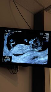 Jesta Hillmann Instagram - J’étais tellement pressé de savoir si j’étais enceinte que j’avais fais des tests bien trop tôt qui m’indiquaient tous négatif. J’avais dis à Benoît que ça n’avait pas marché cette fois ci dès le premier essai.. 2 jours plus tard, un soir je décide de faire un dernier test car mon corps me disait le contraire.. et paf ! Même si je suis tombé enceinte directement après l’arrêt de la contraception c’était finalement une surprise de voir cette très très fine et légère deuxième barres qu’on espérait tant 🥹🙏🏼 C’était voulu et très rapide mais du coup l’émotion fut intense 🤍