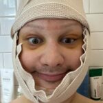 Jinkx Monsoon Instagram - 2024 so far, in a nutshell. Having the ability to have Facial Feminization Surgery is a privilege. Living somewhere where I can easily access HRT and other gender affirming care, is a privilege. These are privileges I have not taken lightly, especially at this time. Last year, while on tour, a trans elder told me: “Jinkx, it’s never too late.” She was right. But let me say, “it’s never too late” means the world to someone still figuring out their path. Also, “it’s never too late” means something different for all of us. I know we don’t all have the same privileges and the same access to care. I will continue to use my voice til the day I die to fight for everyone, everywhere who is worried that it’s “too late.” We all find our path. We all find our time. You do you, however you want to do you, whenever you can— it’s never too late.
