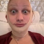 Jinkx Monsoon Instagram - 2024 so far, in a nutshell. Having the ability to have Facial Feminization Surgery is a privilege. Living somewhere where I can easily access HRT and other gender affirming care, is a privilege. These are privileges I have not taken lightly, especially at this time. Last year, while on tour, a trans elder told me: “Jinkx, it’s never too late.” She was right. But let me say, “it’s never too late” means the world to someone still figuring out their path. Also, “it’s never too late” means something different for all of us. I know we don’t all have the same privileges and the same access to care. I will continue to use my voice til the day I die to fight for everyone, everywhere who is worried that it’s “too late.” We all find our path. We all find our time. You do you, however you want to do you, whenever you can— it’s never too late.