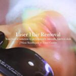 Joselyn Dumas Instagram - 5 star quality Laser in Accra can be found @jnissi_skinrepair_centre ⭐️⭐️⭐️⭐️⭐️ Our state of the art Laser Hair Removal machine is efficient, effective and safe for all skin types ⭐️ Book your LHR treatment with @jnissi_skinrepair_centre today and start your journey to achieving your most flawless skin yet⭐️ Questions? 💌DM us! Call/Text to book ☎️0278555478 🌍 Website: www.jnissi-skinrepair.com 📍 Location: 11 Bamboo Street, East Legon