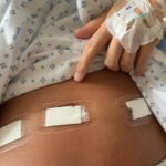 Julia Paredes Instagram - Chère endométriose, voilà plus de 10 ans que j’apprends à vivre avec toi , j’ai décidé aujourd’hui de dire stop, stop à ces douleurs , à cette fatigue chronique, à ces vertiges et nausées et ces saignements à longueur de journée . J’ai fait confiance à la chirurgie robotique et à mon médecin qui hier m’a retiré toute mon endométriose et mon adenomyose. Je suis toujours dans mon lit d’hôpital et je peine encore à me lever, à marcher ou même à respirer correctement mais je sais que des que ces symptômes disparaîtront je vais revivre. Ça me paraît encore irréel de vivre normalement sans douleur et sans contrainte car je vie depuis des années avec cette maladie qui m’empêchais d’être la vraie moi, cette fille pleine d’énergie et d’ambitions , de joie de vivre , je n’arrivais plus à rien au fur et à mesure que cette maladie grandissait et causait de plus en plus de dégâts . À partir d’aujourd’hui je vais redevenir cette fille je l’espère et une maman en pleine forme pour mes deux trésors . Je tiens aussi à remercier mon chirurgien ainsi que toutes les infirmières et personnels de l’hôpital qui ont été aux petits soins avec moi. Mais aussi à vous qui avez été d’un grand soutien ❤️ Au premier jour du reste de ma vie #endometriose#endogirl#chirurgie#robotique#dubai