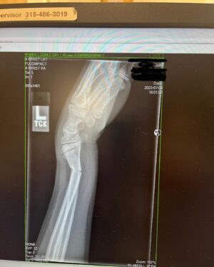 Julie Bowen Instagram - It’s not a vacation without a trip to the ER for a broken wrist… Both bones broken, but John is  on the mend and his brothers were total champs.