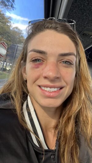 Mackenzie Dern Instagram - 🇺🇸Everything happens at the right time. Of course I was wishing my best performance at MSG and not my first TKO loss, lol but I Trust in Gods plans! I have to learn, to control my emotions! I got caught in the emotional fight, which wasn’t the plan. I wanted to do a lot, but not get in big exchanges, where it’s risky. I took 4 knockdowns, that was the first lol Once again I was tested, given the opportunity and didn’t pass. This is the risk when we enter the octagon, I knew it was going to be a good fight, because we both go for the finish. But I learned a lot and the focus is the belt! Thank you everyone who believed in me, who supports me in victory and defeat, and who continues to believe in me. Sorry for any disappointment, I’m fine, my heart is tight, it hurts, but the rest is all right. Going back to my daughter now and enjoy time with my family and train more because I’ll be back soon. The goal continues, I just need to work more calmly, this warrior has a lot of emotion in everything she does! Lol fall 7 times and get up 8! #MKNZ
•
•
🇧🇷Tudo na hora certa! Não foi a minha hora! Tenho que aprender! A controlar em cima de tudo minhas emoções, entrei na briga emocionada, que o plano não era esse. Queria fazer muita coisa, menos entrar na briga aonde tem o risco. Tomei 4 knockdowns, essa foi a primeira Rs claro que aprendi bastante, mas tenho um trabalho duro para fazer agora, para voltar mais forte que nunca. De chegar nesse cinturão! Mais uma vez eu fui testada, dada a oportunidade e não passei. Mas eu vou de novo, podem ficar tranquilo que vou conseguir. Esse é o risco quando a gente entra lá no octógono, sabia que ia ser uma luta boa, porque nós duas vamos para acabar com a luta. Agradeço todos que acreditaram em mim, que me apoiam na vitória e na derrota, e que continuam acreditando em mim. Desculpa qualquer decepção, estou bem, estou com meu coração apertado, doendo, mas o resto tá tudo certo. Voltar para minha filha agora aproveitar com a familia e treinar mais porque em breve estou de volta. O objetivo continua, só preciso trabalhar com mais calma, essa guerreira é muito emocionada em tudo que faz! Rs cair 7 vezes e levanta 8! #MKNZ