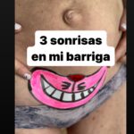 María Castro Instagram – Esta cicatriz me pilla con experiencia. Siempre pensaré que la huella de mi cesárea en mi piel, es como una sonrisa… la sonrisa más bonita que me hayan podido “dibujar” jamás… 

Y es que mis hijas decidieron salir por la puerta grande, y no iba a ser yo la q les dijese que no podían hacerlo… porque obviamente, aunque hubiese preferido que las tres hubiesen nacido por “donde tocaba”, no teniendo posibilidades de elegir, lo importante era llegar… y aquí están!!!!!

Y una vez aquí, y mientras una distinta y tamb se agota jajajaja, tenía q dejarme un “hueco” para que la sonrisa de la tripa luciese lo más bonita posible. Y como? Pues con eficacia y  sobre todo cómoda y fácilmente con @trofolastin Cicatrices, que reduce de forma visible las cicatrices hipertróficas y queloides, en tan solo 8 semanas. Ojalá lo hubiese sabido con Maia, que se me formó un queloide de 10 cm de largo y 1 de grosor, que empezó a desaparecer a los tres años de dar a luz…. TRES AÑOS!!!!

Con Oli no me pillo ya desprevenida y con Emma repito experiencia. Porque lo q funciona no lo cambio, y encima recorto el parche, me lo coloco y hasta que pasan  unos 7 días, ni me acuerdo… pudiéndome duchar igual, e incluso tomar el sol, porque tienen protección. 

Pues hala, tod@s a la farmacia… no vayáis a decir luego que no os avisé! #publi