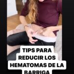 María Castro Instagram – OJALÁ OS SIRVA PARA MUCHO!
Mis/vuestros tips para pincharme mejor y reducir los hematomas de la barriga!
Ah!! Y muy importante!!! NO FROTAR LA ZONA al terminar… aunq pique!!!!
