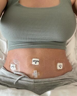 Maryse Mizanin Instagram - As you know, 2 weeks ago I went in to surgery to have my ovaries/uterus/tubes/cervix/omentum removed. I also had staging (removal) of the lymph nodes in my abdomen to see if the disease had spread. 
Pathology confirmed that it had not which is amazing news! More amazing news is that I am tumor free! The diagnosis did confirm that I had Primary Peritoneal Serous Borderline Tumors with involvement of ovaries/uterus/tubes!
Just to give you an idea of the rarity - 7 cases per million of women in the US per year! The fact that we not only found this but found this at this manageable stage is unbelievable and literally saved my life as this would have most likely been lethal. 
Next, I will continue to rest following my surgery and then will follow up with specialists at MD Anderson in Houston. 
I can never say thank you enough to my doctor @drthaisaliabadi and her team! THANK YOU THANK YOU THANK YOU!!!! 
I’m overwhelmed by the amount of support I’m getting from family, friends and fans all over the world! To all my women, please keep being your own advocate and trust yourself always! ❤️❤️❤️