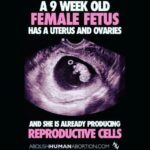 Mia Dinoto Instagram - Enough with the euphemisms. If you support killing babies, just say it. Abortion is murder and that’s a fact. Facts don’t care about your feelings so whatever emotional excuse you have for killing babies doesn’t matter because it’s NEVER ok to kill an innocent human life. - #TurnToJesus #memes #memesdaily