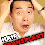 Nigel Ng Instagram - But are you ready for a podcast on the day Nigel gets a hair transplant?!? 😳😂 Taken from ep 33 of the @haiyaapod watch the full episode on YouTube and listen to it wherever you get your podcasts!! #uncleroger