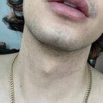 Paolo Ballesteros Instagram - Tinatablan den po ako ng pimple… sobrang bihira lang pero hard 😅🥴 galing sa kabilang side lumipat pa sa kabila 😝 may tulog sa likod 😉
