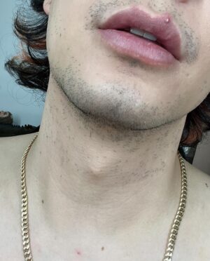 Paolo Ballesteros Instagram - Tinatablan den po ako ng pimple… sobrang bihira lang pero hard 😅🥴 galing sa kabilang side lumipat pa sa kabila 😝 may tulog sa likod 😉