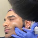 Paras Chhabra Instagram - Teeth grinding, often fueled by anxiety and stress, can wreak havoc on both dental health and overall well-being. Enter Botox: a game-changer at Osderm Clinic. Beyond the physical relief, patients like Paras experience a newfound sense of calm and confidence. Say hello to a stress-free smile with Botox at Osderm Clinic.💙 Star Treatments: ✨Laser Hair Reduction ✨HIFU ✨Medi-Facials ✨Korean Peel ✨Fillers & Threads 📞: 91 78143 00800 Visit us at 📍Sareen’s 40, Aaram Nagar Part 1, Versova Andheri West - 400061 . . . #MediaFacialMagic #GlowGoals #SkincareJourney #FacialRevolution #HealthySkin #RadiantResults #SkinCareEssentials #MediaFacialGlow #GlowingSkin #SkincareRoutine #FacialCare #YouthfulGlow #SkinTransformation #SelfCareSunday #DermatologyLove #BeautyFromWithin #FacialRefresh #SkinLove #PamperYourself #SkinWellness #TimelessBeauty #FacialTreatments #SpaDayEssentials #SkincareMagic #healthyglow