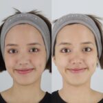 Ploypailin Thangprapaporn Instagram - สามปีแล้วกับการมาดูแลความจ๋วยที่นี่ @truetrustclinic เป็นที่ที่ทำ thermage แล้วเห็นผลชัดมากตั้งแต่ตอนทำเลย แล้วก็มาเลเซอร์กระด้วย🥹 แต่ถ้าใครจะชอบเติมหน้าแบบอื่นคนหมอก็ทำได้ แนะนำดีมากๆ คุณหมอตูนน่ารัก🤣❤️ ขอรูปคลีนิคมารีวิวเอง เพราะประทับใจ อยากให้มีคนไปทำเยอะๆ ปังๆ