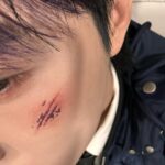 Renjun Instagram – 🩸
