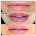 Rosa Blasi Instagram - Set Secret alert! #LipBlushing gives you fuller looking lips and natural color without using makeup or fillers!!!👄 Check out the artistry of @mehringlam. I’m thrilled with the results (like a reverse time machine for your lips!) tag someone below who needs to know about this trend #lipblush #microblading #mehringlam #beautytrends #setsecrets #beforeandafter 😍