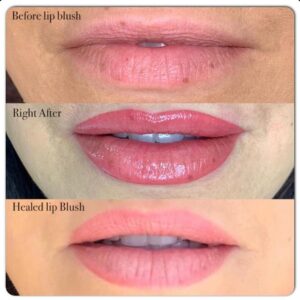 Rosa Blasi Instagram - Set Secret alert! #LipBlushing gives you fuller looking lips and natural color without using makeup or fillers!!!👄 Check out the artistry of @mehringlam. I’m thrilled with the results (like a reverse time machine for your lips!) tag someone below who needs to know about this trend #lipblush #microblading #mehringlam #beautytrends #setsecrets #beforeandafter 😍