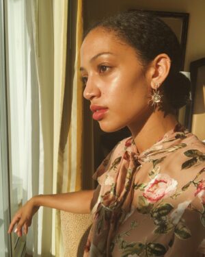 Samantha Logan Instagram - dreaming of when my skin wasn’t freaking the fuck out 👍🏽👍🏽👍🏽