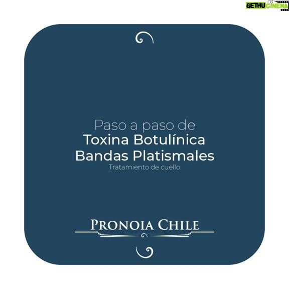 Sigrid Alegría Instagram - Toxina Botulínica tratamiento de cuello 💉💁♀️💁♂️ Acompáñanos a ver el paso a paso de una sesión de Toxina Botulínica en Bandas Platismales para ayudar a estilizar el cuello 💉💁♀️💁♂️ junto a @pronoiachile y @sigridalegria