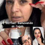 Solange Gomes Instagram - É incrível! É @agerenovaoficial Não vivo mais sem ele. Vem comigo que te explico. #beleza #botox #rejuvenescimento #rejuvenescimentofacial