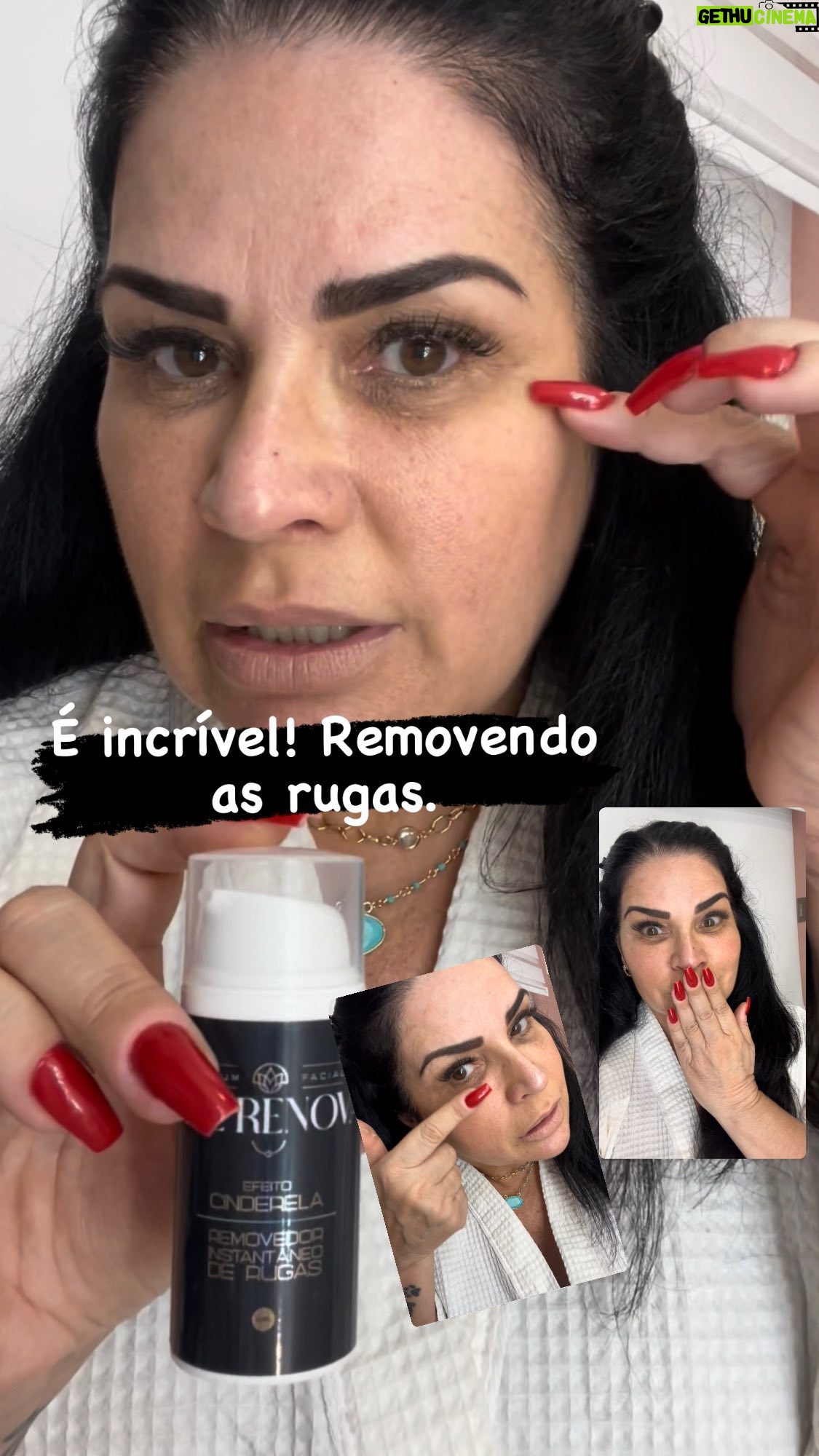Solange Gomes Instagram - É incrível! É @agerenovaoficial Não vivo mais sem ele. Vem comigo que te explico. #beleza #botox #rejuvenescimento #rejuvenescimentofacial