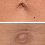 Stéphanie Clerbois Instagram - S’il y a bien une chose que l’on sait, c’est que chaque morphologie est différente et unique. Et malgré les « tendances du moment » (qui entre nous changent tout le temps comme s’il s’agissait de porter un vêtement sur soi), le but n’est pas de ressembler à telle ou telle nana sur les réseaux mais plutôt d’accepter son corps tel qu’il est et de travailler sur nos « petits » défauts, ceux qui nous dérangent pour se sentir en harmonie avec lui. Nous n’avons pas toutes le même âge, nous n’avons pas toutes les mêmes gènes, nous n’avons pas eu les mêmes problèmes dans nos vies qui ont pu avoir de lourdes répercussions sur celui-ci. Et sans oublier par la même occasion la case bébé : « on ne fait pas d’omelette sans casser des œufs ».🤪 Alors oui notre physique change, oui nous resterons des éternelles insatisfaites (c’est notre devoir en tant que femme 😁) mais une chose est sûre c’est que plus nous en prendrons soin plus nous arriverons à l’aimer à sa juste valeur.💪 @ts_nutrition_coaching @maderotherapie_byadna
