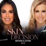 Stephanie Pratt Instagram - How amazing was #SkinDecision on @Netlfix last night?!!! WOAH 🤩. Not only my friend of 13 years... but also the talented GENIUS @nursejamieLA who has transformed my skin. I love you, keep killing it! @SkinDecision @beautyparkspa